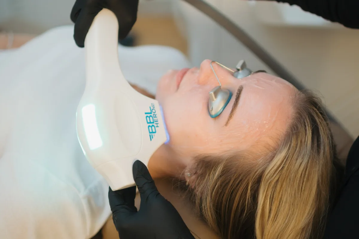 BBL Clear blue light acne treatment at Oak Haus