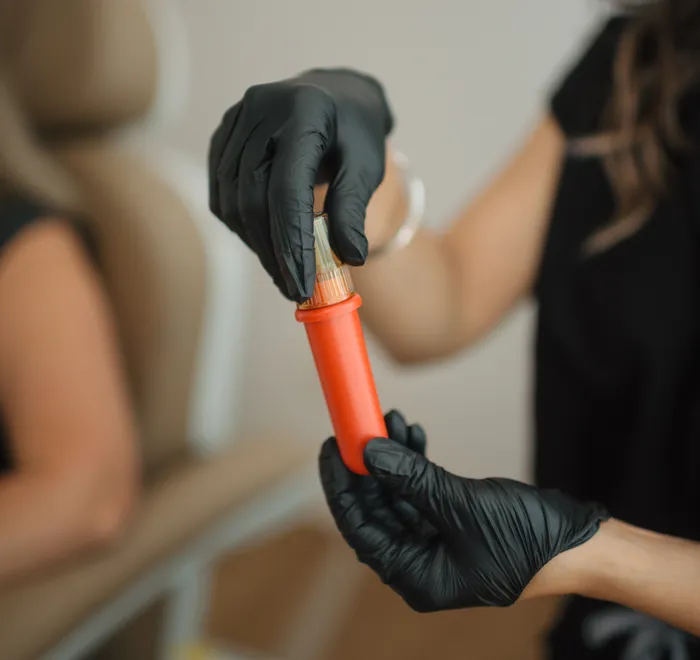 PRFM (Platelet-Rich Fibrin Matrix) tube prepared at Oak Haus