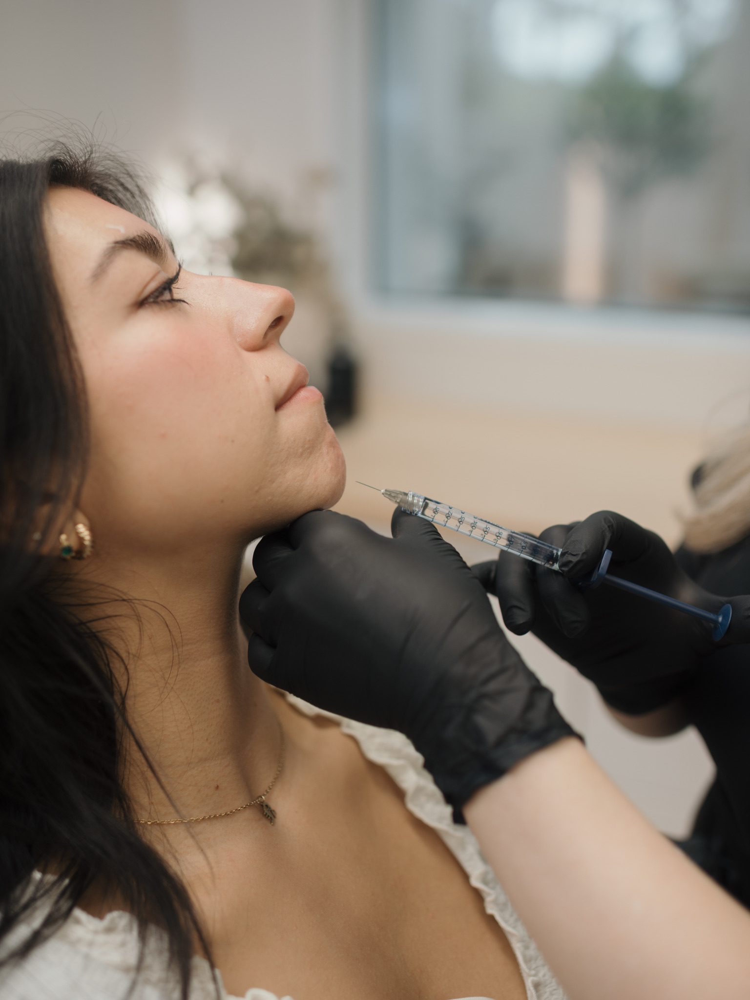 Dermal filler treatment at Oak Haus